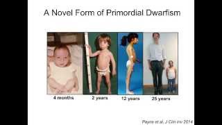 European Journal of Endocrinology Lecture: Robert Semple