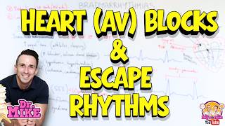 Bradyarrhythmia | Conduction Blocks & Escape Rhythms