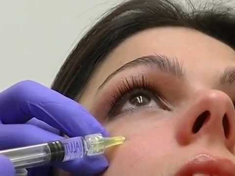 La competizione diventa la faccia della società cosmetica Affronti il pacco con una fotografia laminaria prima di e poi