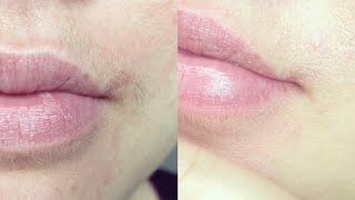 Gesichtsbehaarung mit Kaltwachsstreifen entfernen Tipps + Fehler, die man meiden sollte I Marina Si