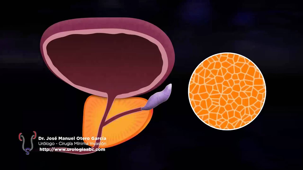 José Manuel Otero García-28