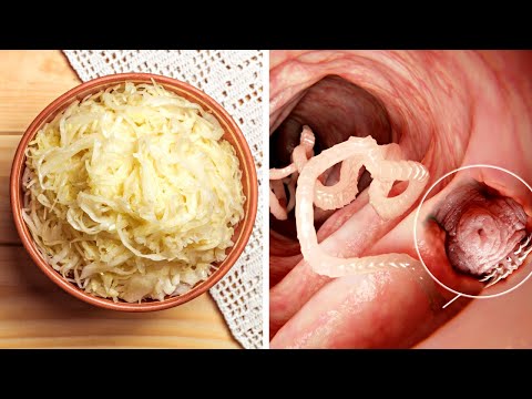 , title : 'Eat These Foods To Sweep Parasites Out of Your Intestines'