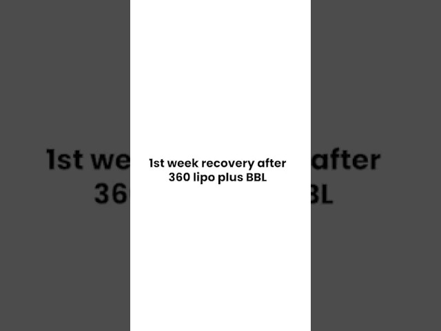 1st week recovery after 360 lipo plus bbl