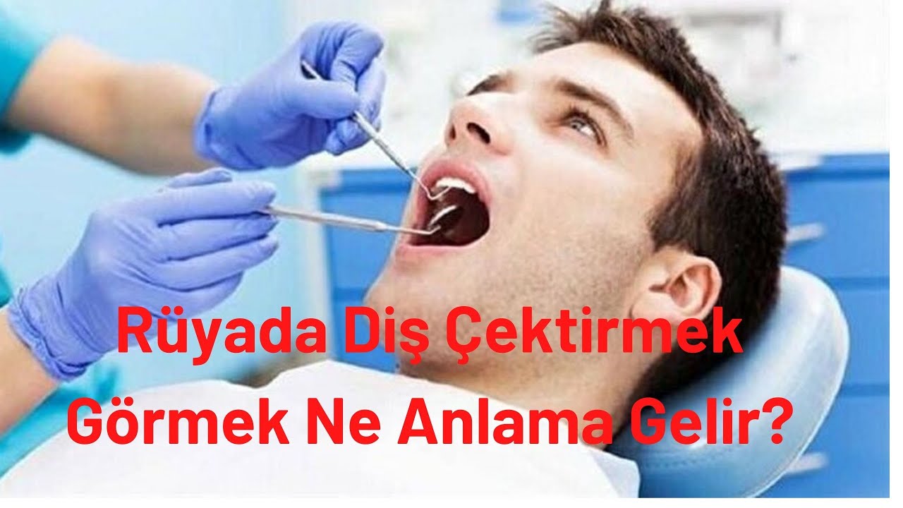 Rüyada Diş Çektirmek Görmek Ne Anlama Gelir