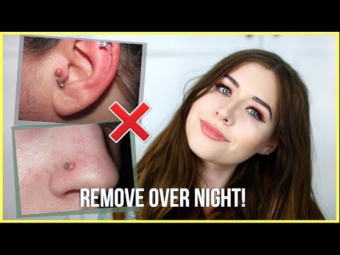 How To Get Rid Of Piercing Bumps OVERNIGHT! - YouTube