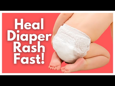 Ultimate Diaper Rash Guide - Tips For Tough Diaper Rashes