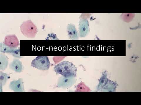 Cervical Cytology #1