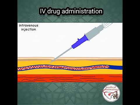 💉 IV DRUG ADMINISTRATION PROCEDURE | ANIMATED EXPLANATION | #shorts #medicine #nurse