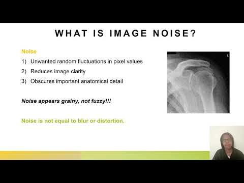 Image Production for the ARRT Registry Exam | Noise, SNR & Exposure Indicators