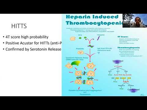 Guidance on diagnosis and management of TTS/VITT-THANZ perspective