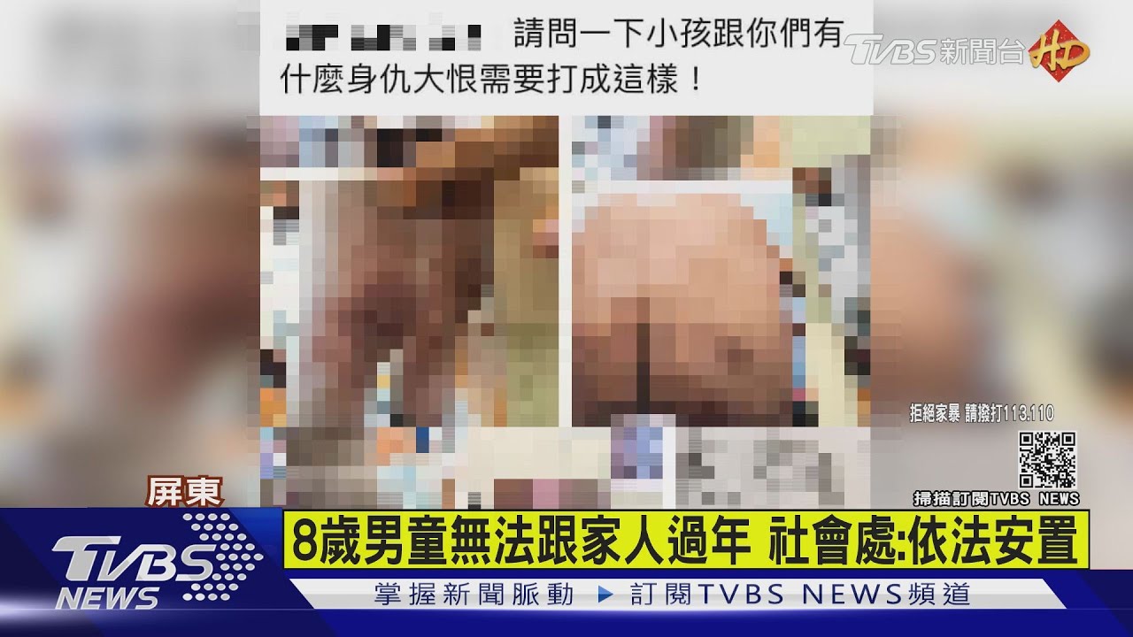 疑遭生母及同居人施暴 8歲男童多處瘀青