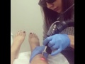 Love Hip Hop co Star Cyn Santana Laser Treatments