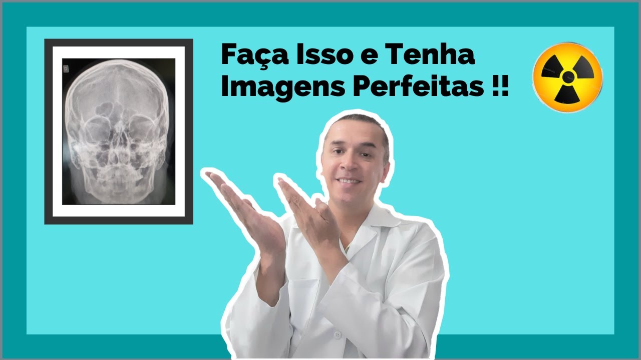 Como Melhorar as Imagens Radiográficas