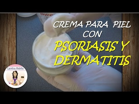 Tra eczema delle dita che trattare Sintomi di neurodermatitis ad adulti