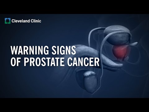 , title : '10 Warning Signs of Prostate Cancer'