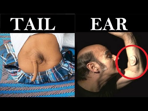 7 People With Weird Extra Body Parts Video