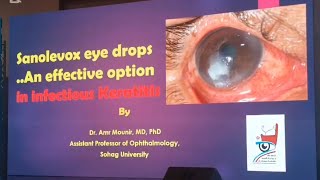 How do you manage infectious keratitis?  Sanocare pharmaceutical company meeting