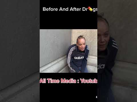 Before And After Addiction 🥺😞 #kensington #addiction #addict