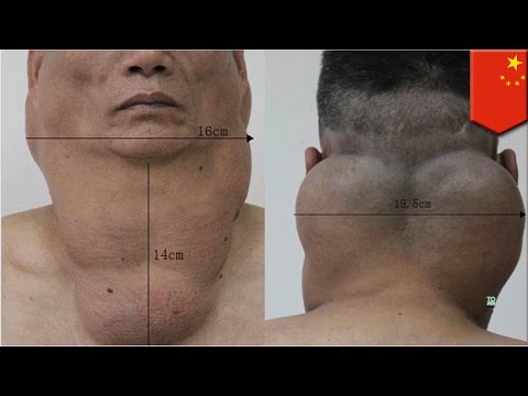 Bagaimana meningkatkan cara rakyat penis Benih jelatang untuk potensi