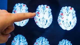 Researchers say there&#39;s evidence that consciousness continues after clinical death