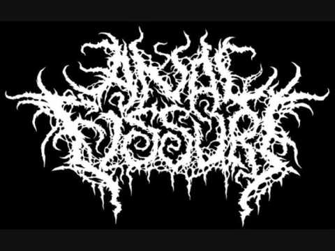 Anal Fissure - Rectal Bludgeoning