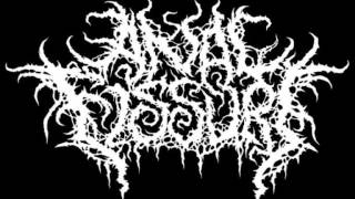 Anal Fissure - Rectal Bludgeoning