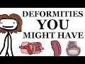 Deformities That You Might Have
