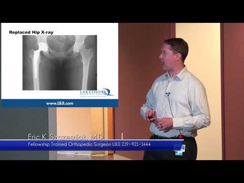 Dr. Eric Szczesniak Discusses Current Topics in Total Hip Replacement
