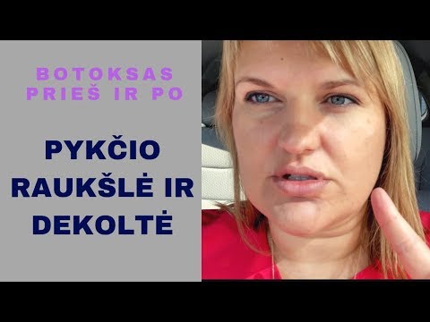 būdai, kaip numesti svorio slaugos metu