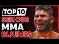 10 MMA Fighters who got SERIOUSLY Hurt (Part 1)