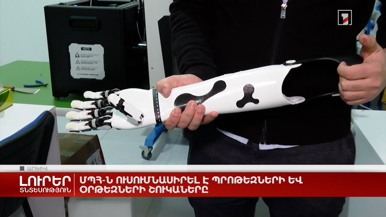 ՄՊՀ-ն ուսումնասիրել է պրոթեզների և օրթեզների շուկաները