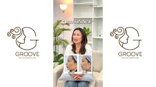 ฝ้ากระ รักษาหลายที่ไม่หาย