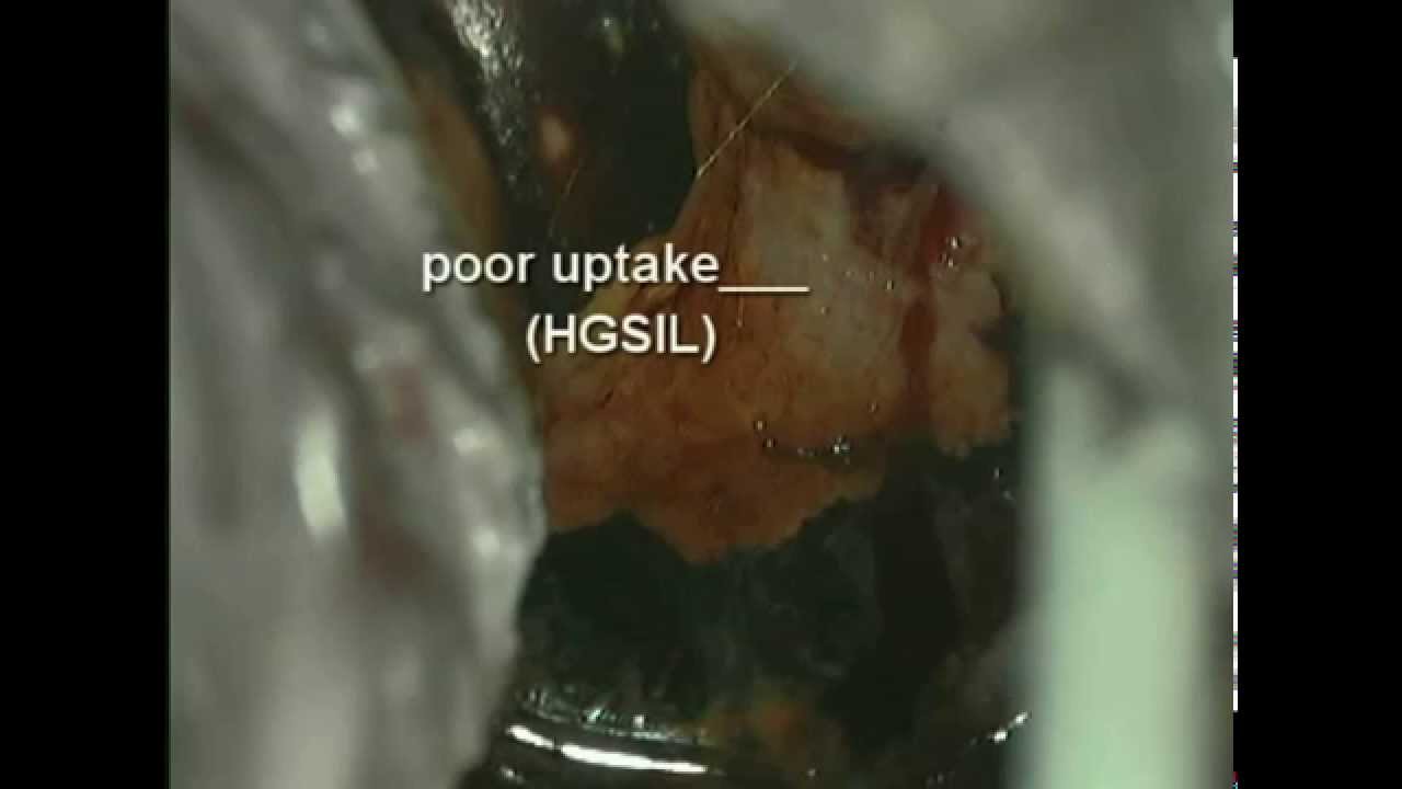 Alicia Martinez Garcia-33