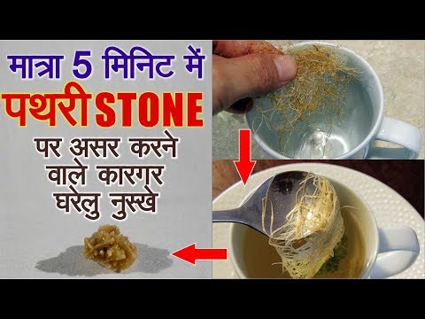 पथरी को ख़त्म करने के असरदार उपाय  उपाय  How to Remove kidney Stone  Naturally With Home Remedy Video