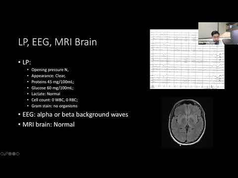 AMIQT Dr Cyrus Cheng - Steroid Responsive Encephalopathy Associated with Autoimmune Thyroiditis