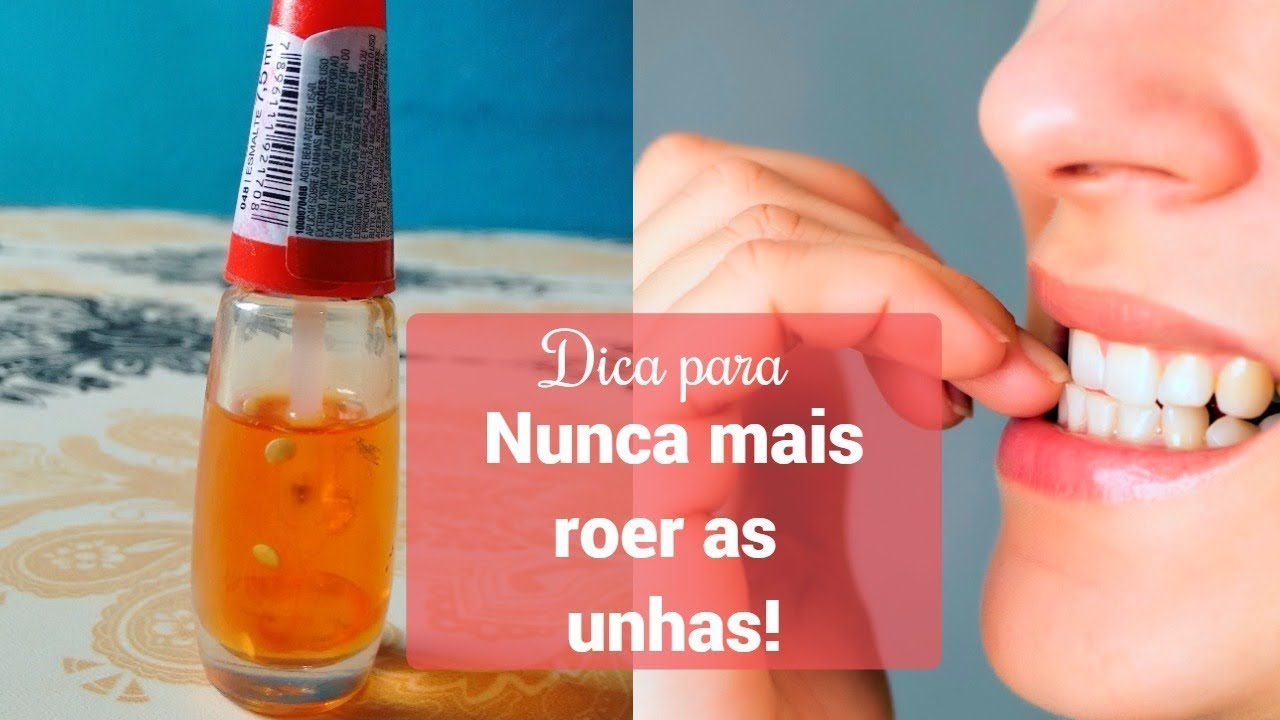 Dica para nunca mais roer as unhas