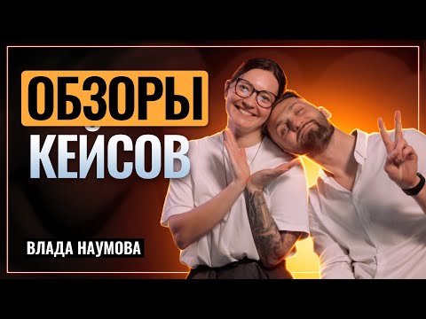 Владислава Наумова - Кейсология | Гипоплазия зубов | Подростковое протезирование