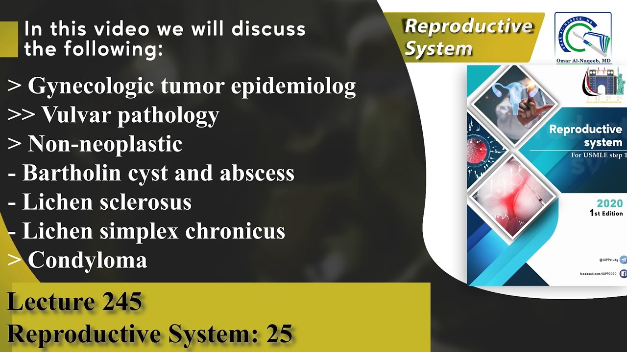 Gynecologic tumor epidemiology | Bartholin cyst and abscess | Condyloma