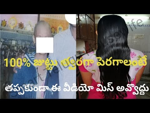 VITAMIN E HAIR OIL FOR EXTREME HAIR GROWTH IN TELUGU||GROW THICK HAIR FASTER #SMARTTELUGUHOUSEWIFE Video