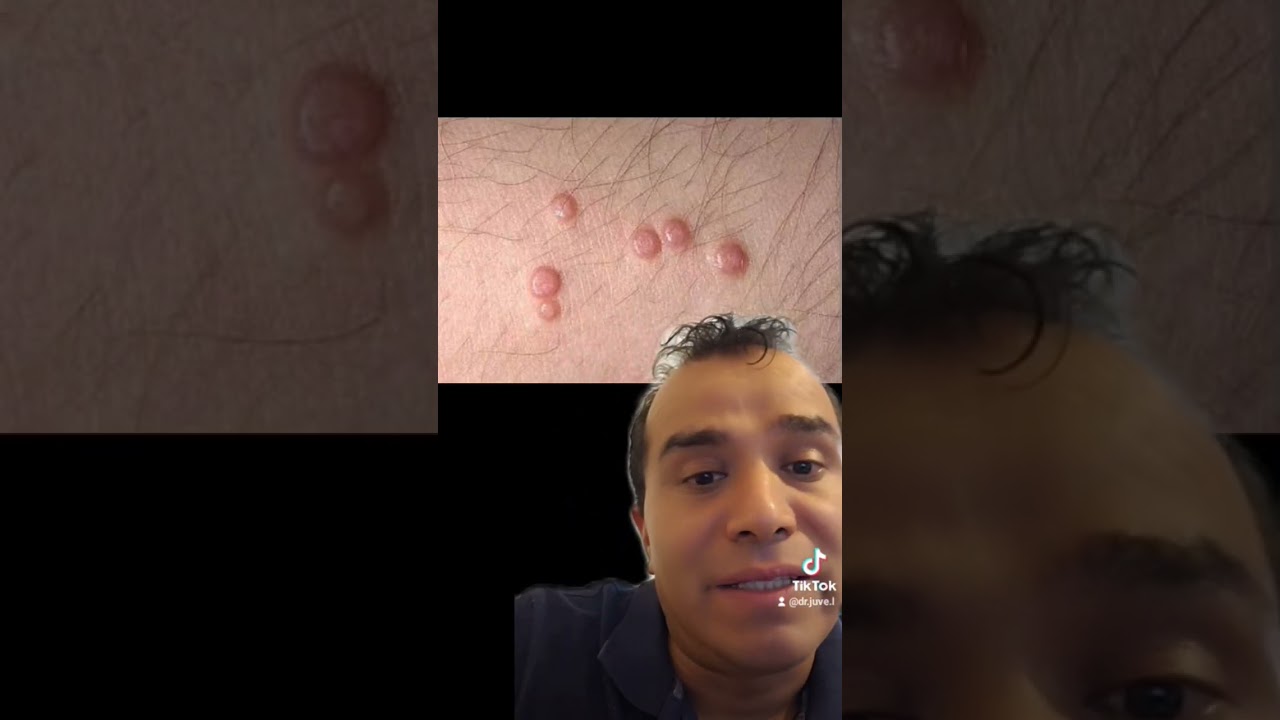 Juventino Lopez Lopez-9