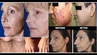 LUMINESCE™ The Secret To A Younger Healthier Looking Skin!