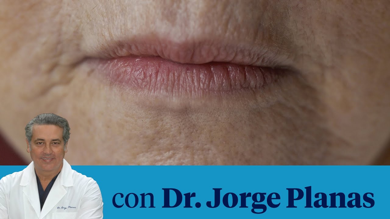 Cómo eliminar el código de barras