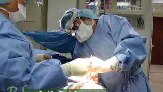Face, Neck Lift and Chin Implant by Dr. Paul Nassif