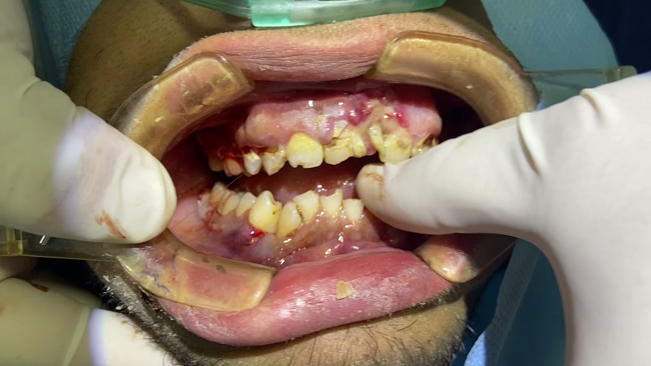 Ivan Israel Hernandez Fernandez-64