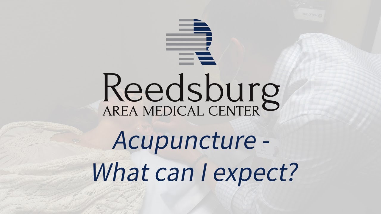 Acupuncture: What can I expect?