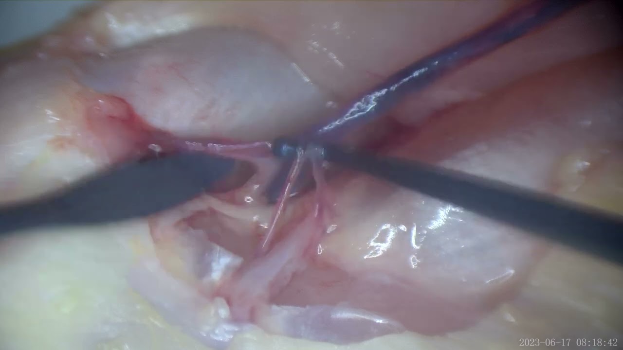 David Tafur Muñoz-2444