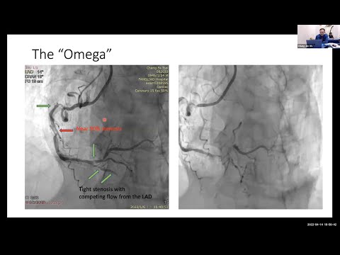 Expressman™ - One step closer to success
