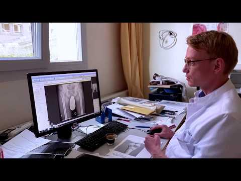 Ortho Daily Five (OD5) - Folge 6 - Prothesenplanung