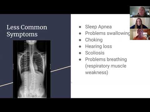 Charcot-Marie-Tooth disease presentation
