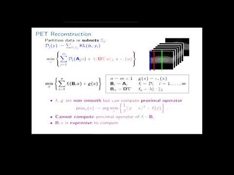 Faster PET Reconstruction with Non Smooth Anatomical Priors by Randomization and Preconditioning